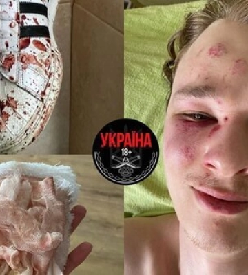 Закарпатський ТЦК про спробу самогубства військовозобов’язаного: Чоловіка не били, він перебував у істеричному стані, рани міг&amp;hellip;