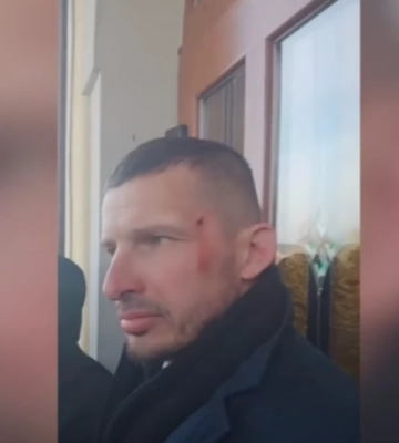 Не може змиритися, що не зможе правити у церкві: на Волині священник УПЦ МП побив священника ПЦУ. Відео