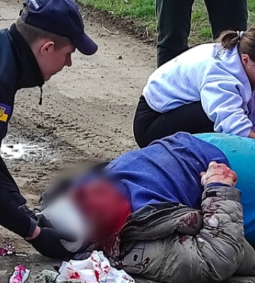 Піротехніки ДСНС надали допомогу постраждалому в дорожньо-транспортній пригоді чоловіку