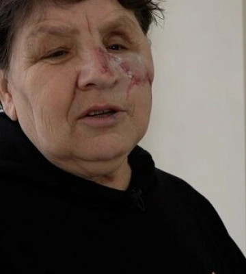 Лікарі з львівського «ОХМАТДИТу» стажувалися у одній з провідних дитячих лікарень у Європі