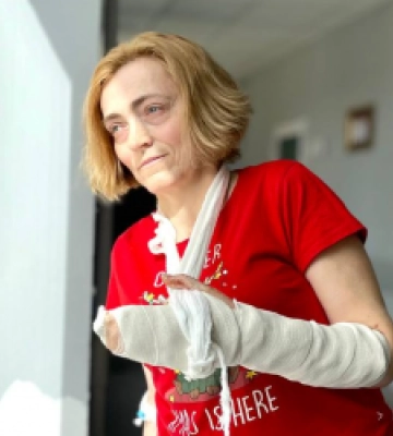 30 років жила зі зрощеними пальцями рук: у Львові прооперували жінку з рідкісним захворюванням