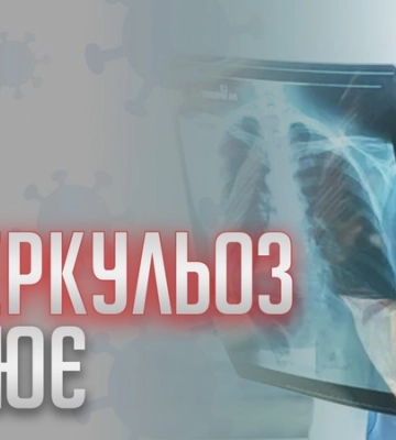 Збільшення випадків туберкульозу в Україні. Симптоми не варто ігнорувати
