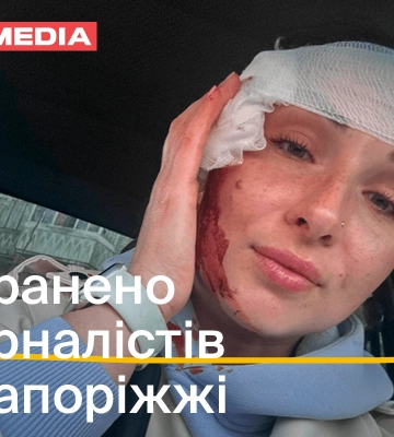 На Запоріжжі під час обстрілу поранена власкор Укрінформу Ольга Звонарьова