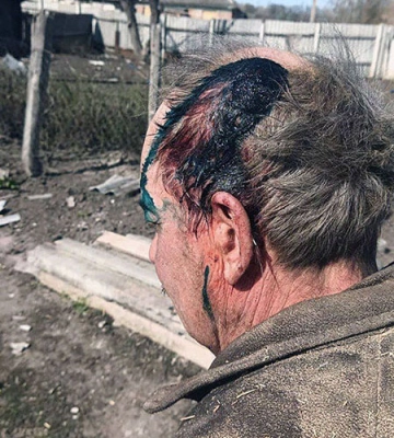Під час російського обстрілу Вовчанська Харківської області постраждала немолода людина