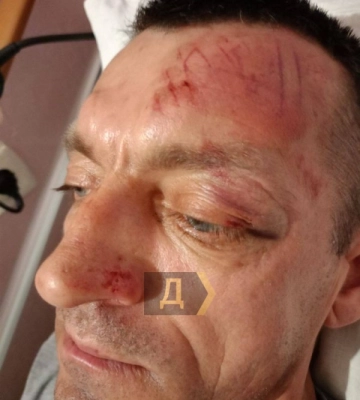 На Одещині група чоловіків побила військового і вкрала в нього гроші