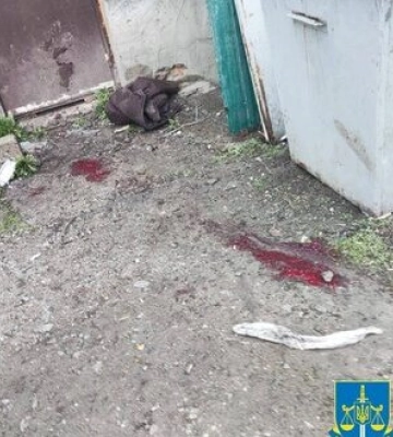 Одна людина загинула і три зазнали поранень унаслідок артилерійського обстрілу Білопілля на Сумщині. ФОТОрепортаж