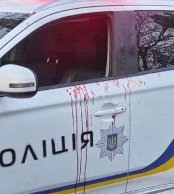 У лікарні розповіли про стан поліцейського, пораненого під час стрілянини у Вінницькій області