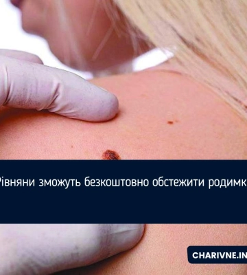 Рівняни зможуть безкоштовно обстежити родимки