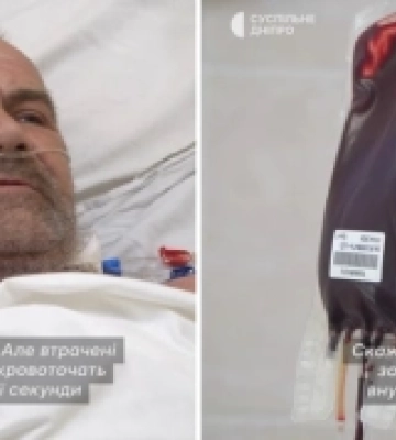 Перелили п&#039;ять літрів крові: захиснику з Волині ампутували обидві ноги. ВІДЕО