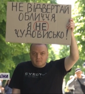«Я не чудовисько»: у Луцьку військовий, який втратив ногу, влаштував акцію