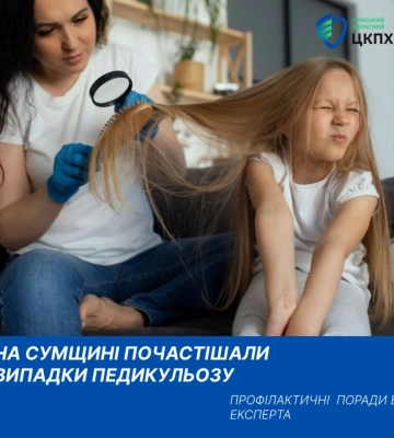 На Сумщині почастішали випадки педикульозу: яка профілактика існує