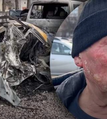 Помер киянин, який після "прильоту" героїчно Сів в палаюче авто, щоб врятувати сусідні