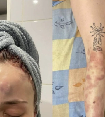Інцидент з побиттям дівчини біля поліцейського відділку: Одеський ТЦК відреагував
