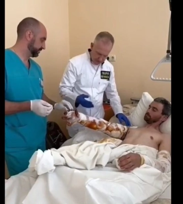 У лікарні Дніпра врятували військового від ампутації обох рук