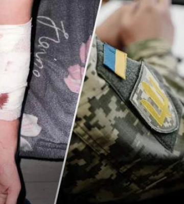 У мережі стверджують, що чоловік порізав вени у ТЦК на Київщині. У військкоматі заперечують, кажуть: спроб самогубства він не&amp;hellip;