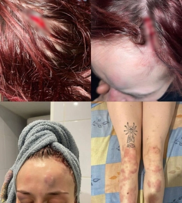 Чоловік у формі побив в Одесі дівчину: звинувачення потерпілої від ОК &quot;Південь&quot; та реакція Міноборони, - ФОТО, ВІДЕО