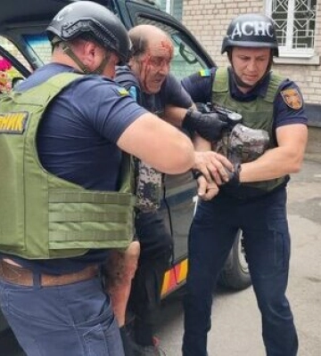 Двох чоловіків поранено внаслідок артилерійського обстрілу Нікополя, один з них - у важкому стані. ФОТОрепортаж