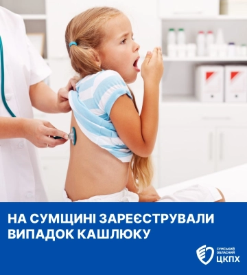 У Кролевецькій громаді зареєстрували випадок кашлюку