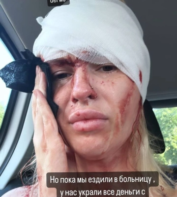 Мародери вкрали всі гроші, авто ремонту не підлягає: після атаки по Кривому Рогу пара повернулась з лікарні і була шокована
