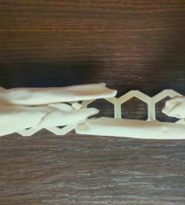 3D-моделювання і алоостеопластика: у Полтаві провели унікальну операцію