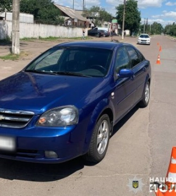У Житомирі під колеса автівки потрапив 65-річний чоловік, його госпіталізували