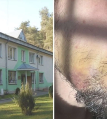 На Волині незаконно утримують і побили іноземця 