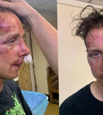 Пред&#039;являли за зачіску: у Києві підлітки побили ветерана війни