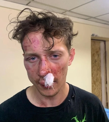 Избиение ветерана в Киеве — подозрение получил 17-летний киевлянин