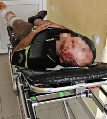 Киянин стрибнув з поїзда, сподіваючись незаконно перейти кордон