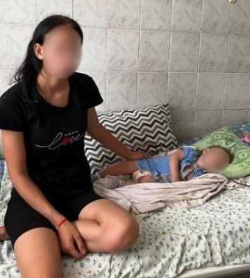 Медики Одещини врятували життя одинадцятимісячної дитини, яка впала у вигрібну яму