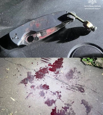 Поліцейські у Чернігові затримали чоловіка, який кидався на людей з ножем