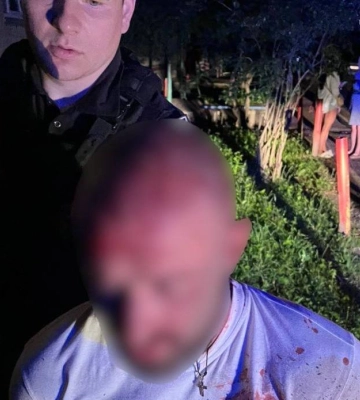 Поліцейські у Чернігові затримали чоловіка, який кидався на людей з ножем