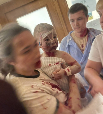 Лікарні Одещини готові прийняти дітей з &quot;Охматдиту&quot;, який постраждала під час атаки РФ на Київ
