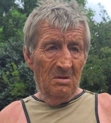На Волині чоловік помер від укусу оси