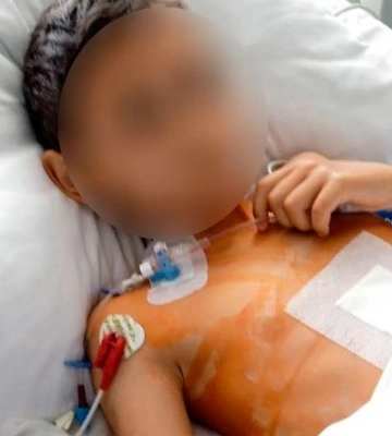 Сумна звістка з Києва: помер 7-річний Єгор Завадецький, жертва російської агресії 