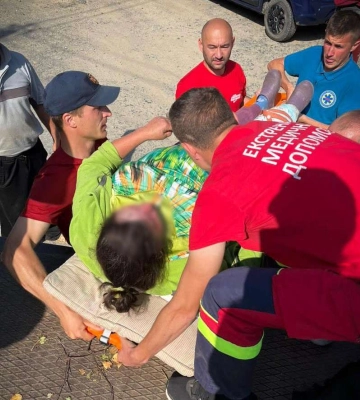 На Рахівщині корова травмувала свою власницю