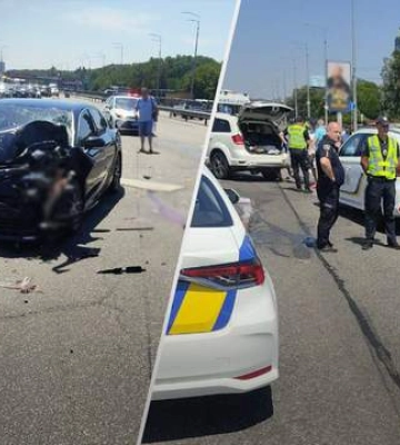 У Києві сталася жахлива ДТП на Столичному шосе: у постраждалої жінки ампутовано ноги