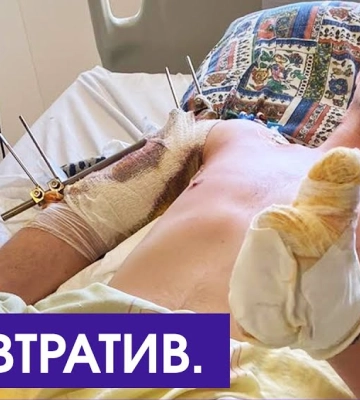 Боєць з Волині втратив на фронті обидві ноги, а зараз бореться, щоб лишитися з рукою. Потрібна допомога