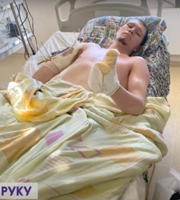 Закрив собою побратима: воїн з Волині, який втратив обидві ноги, бореться за праву руку