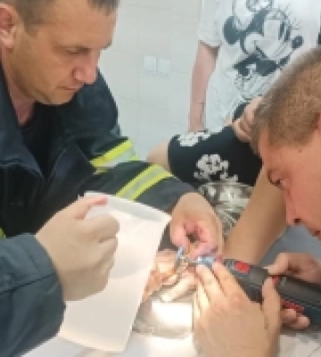 У Луцьку рятувальники допомогли хлопцю, який не міг зняти з пальця кільце