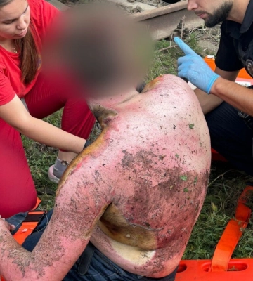 Під Одесою двоє підлітків постраждали від удару струмом на залізниці