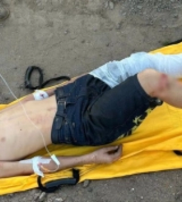 Під Одесою двоє підлітків постраждали від удару струмом на залізниці
