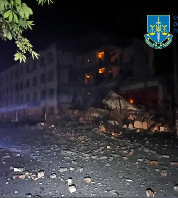 Під час бомбардування СумДУ поранено охоронця