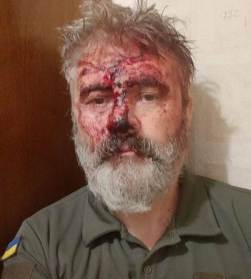 У центрі Києва побили митрополита Сімферопольського і Кримського Климента