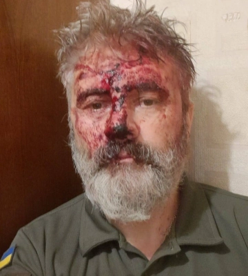 У Києві біля Михайлівського собору напали на священника, який є військовослужбовцем