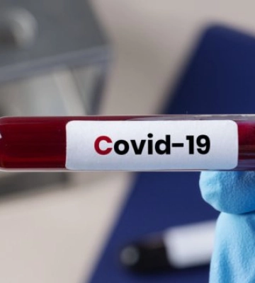 За останні півтора місяця від COVID-19 на Полтавщині померло 7 людей
