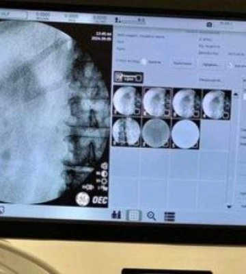 Миколаївська лікарня отримала сучасний хірургічний рентгенапарат від французьких благодійників