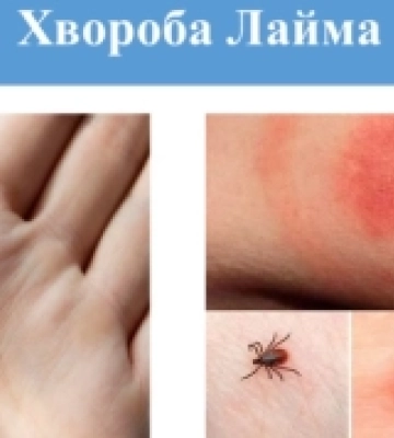 Мешканець Рівненщини, який повернувся з лісу з кількома пакетами грибів, назвав &quot;урожайну&quot; локацію (ФОТО)