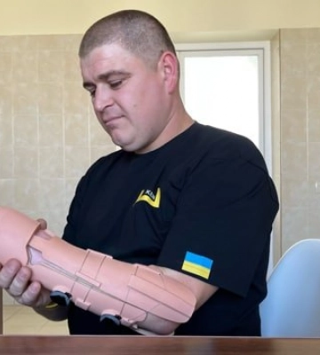 У львівському центрі «Незламні» українцю встановили найлегший у світі протез (ФОТО)