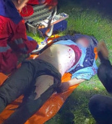 У Переяславі на Київщині від вибуху постраждала людина, поряд знайшли чеку від гранати